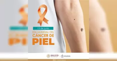 Cáncer de piel