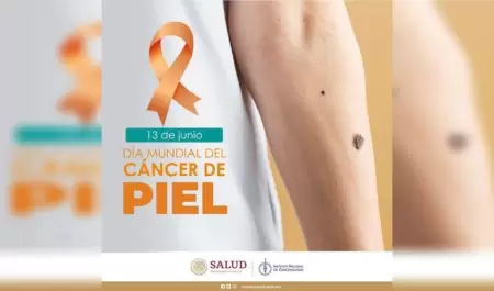 Cncer de piel