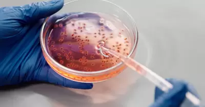 Anlisis de laboratorio, bacterias