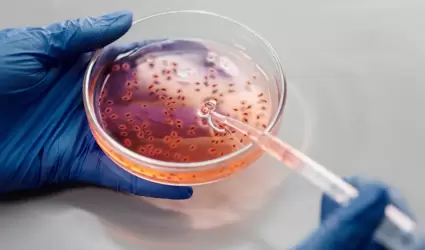 Anlisis de laboratorio, bacterias