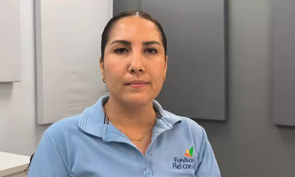 Janeth Vzquez, gerente de la Fundacin Piel con Vida
