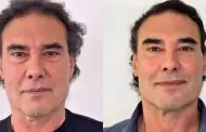 Eduardo Yez se somete a tratamiento de rejuvenecimiento facial