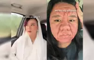 VIDEO: Joven en Malasia mostr en redes el drstico cambio que sufri su rostro durante el embarazo