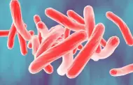 Tuberculosis: Especialista explica contagio aéreo y vulnerabilidad