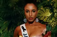 Miss Jamaica sigue bajo observacin mdica tras accidente