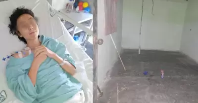 Menor supera rickettsia