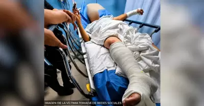 Hombre golpeado afuera de la ExpoGan