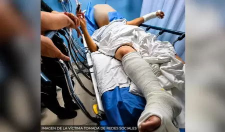 Hombre golpeado afuera de la ExpoGan