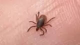 Rickettsiosis