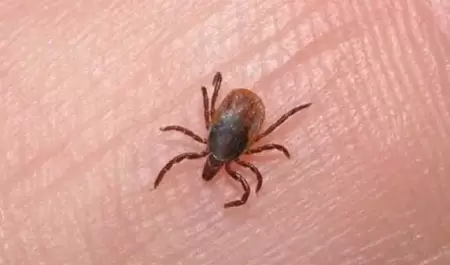 Rickettsiosis