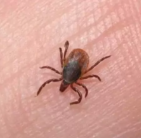 Rickettsiosis