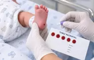 Isssteson detecta fibrosis qu�stica desde el nacimiento