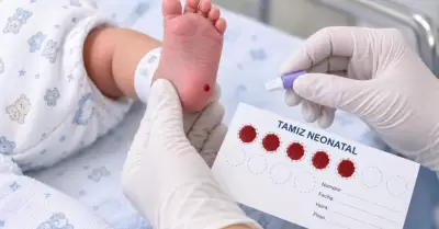 Tamiz neonatal