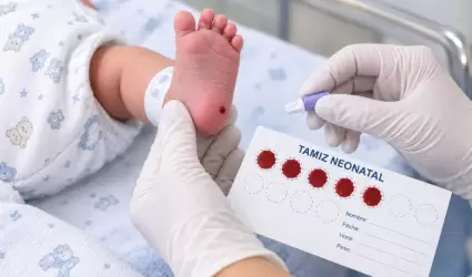 Tamiz neonatal