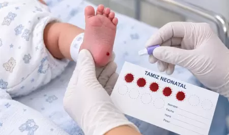 Tamiz neonatal