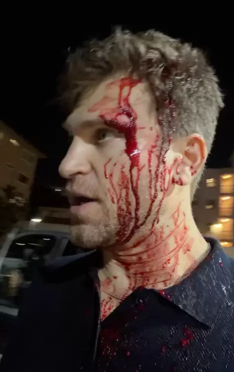 Keegan Allen