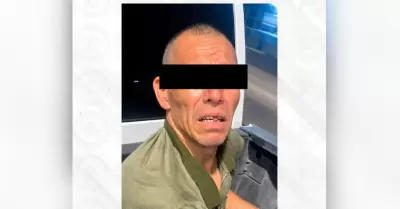 Sujeto agredi� con aceite hirviendo a dos agentes de la AMIC